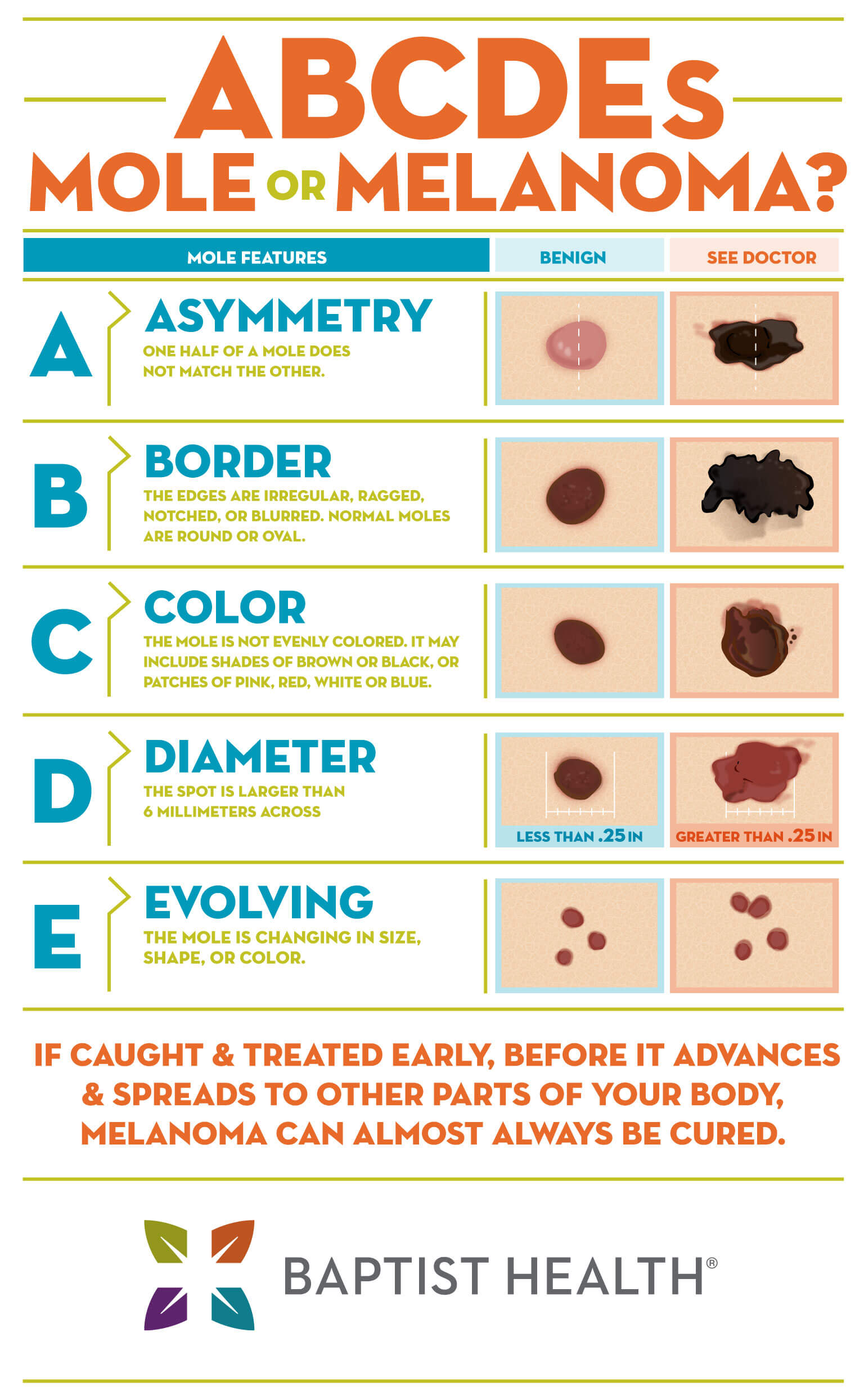 ABCDE's of melanoma